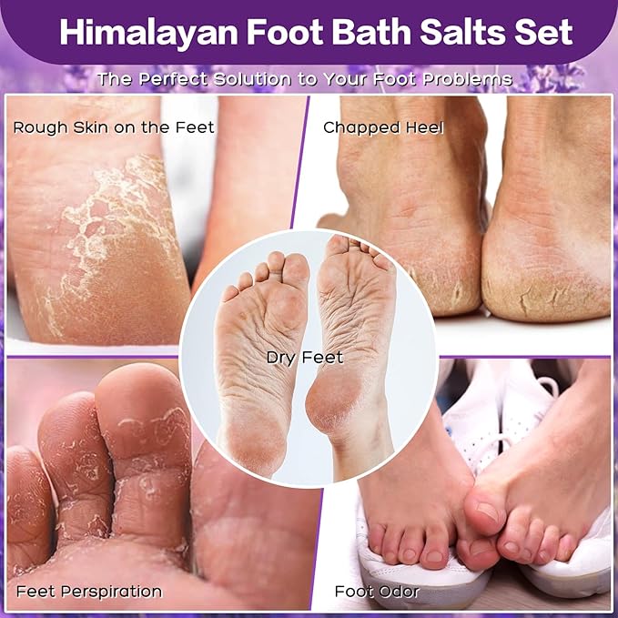 Tea Tree Oil Foot Soak Stubborn Foot Odor, Athletes Lavender Foot Soak with Pure Epsom Salt Soak Pedicure Salt Athletes Foot & Stubborn Foot Bath Salt Softens Calluses & Soothes Foot Care spa…