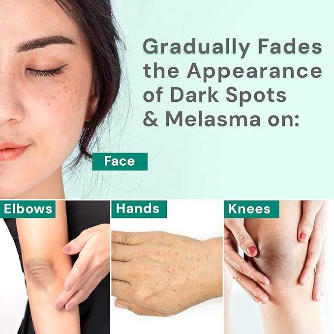 Ebanel Dark Spot Remover for Face & Body, Skin Brightening Cream with Synovea, Alpha Arbutin, Niacinamide, Kojic Acid, Dark Spot Corrector for Hyperpigmentation, Discoloration, Melasma, and Age Spots