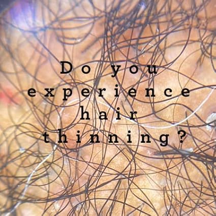 G+H Strengthening Oil | Promotes Thicker, Fuller Hair & Healthy Scalp | With Pumpkin & Rosemary for Healthy Hair | For All Hair Types (2 fl oz)