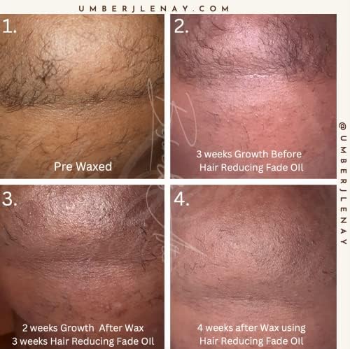 Hair Reducing Fade Oil - Sentive Strength (For sentive skin) Hair Growth Minimizer, Slow Down Facial Hair Growth for Women & Men, Hair Inhibitor Serum, Moisturizing & Soothing, 15ml