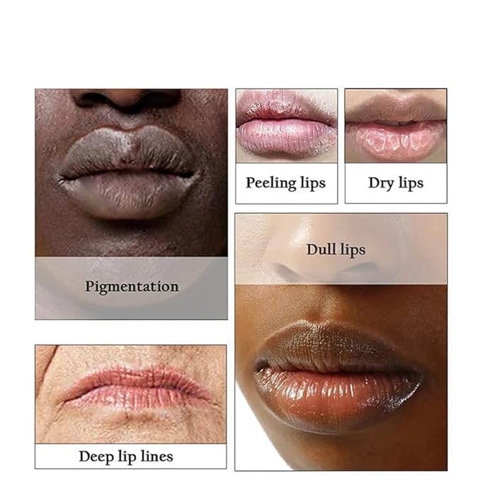 2PCS Lips Pink Fresh Lightening Bleaching Cream Treatment Remove Dark Smoke Lips Lips Bleaching whitening Essence Lip Balm (pink), 2 Count (Pack of 1)