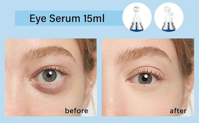 5% Caffeine Eye Serum, Under Eye Roller Cream for Dark Circles and Puffiness with 360°Massage Ball Reduce Wrinkles and Fine Lines，Bags Under Eyes，15ML