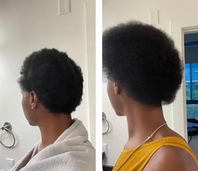 BUR BUR Growing Season Hair Growth And Repair Oil | With Burdock, Nettle Oil and Vitamin C for Visibly Fuller, Stronger and Shinier Hair.