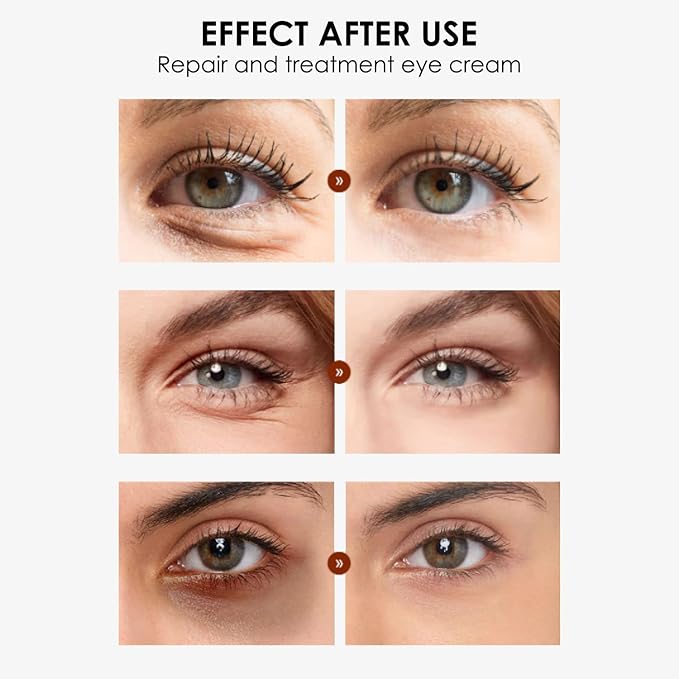 Eye Cream, STCORPS7 Vibrant Glamour Silk Protein Anti-Wrinkle And Firming Eye Cream For Wrinkles, Fine Lines, Dark Circles, Puffiness & Bags, 20g