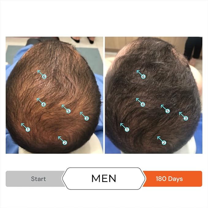 DS Labs Revita Shampoo 205mL & Tablets Kit – High-Performance Hair Density Shampoo, Hair Vitamins, Volumizing & Thickening, Fuller, Healthier-Looking Hair for Men & Women