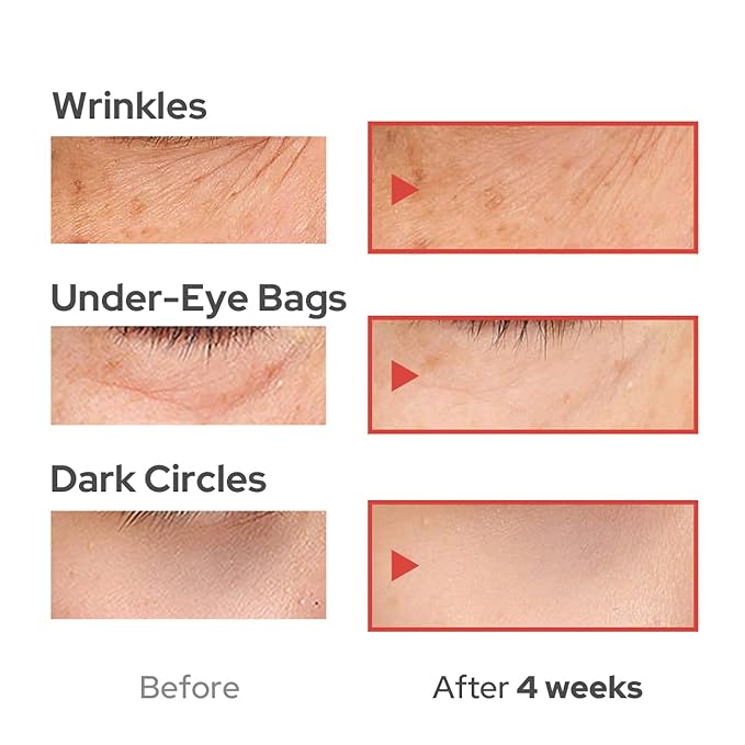 DUFT & DOFT Vgene Hydro Firming Lifting Booster Eye Cream - Anti Wrinkle, Dark Circles, Depuffing with Collagen and Niacinamide 0.9 Fl Oz