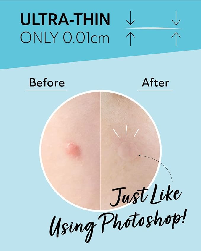 Invisible Salicylic Acid Pimple Patches for Face - Redness Reducing Hydrocolloid Acne Patches, Clear Pimple & Zit Patches for Blind Pimples - Soothing Plus (Clear Patch) (Intensive-36dots-2)