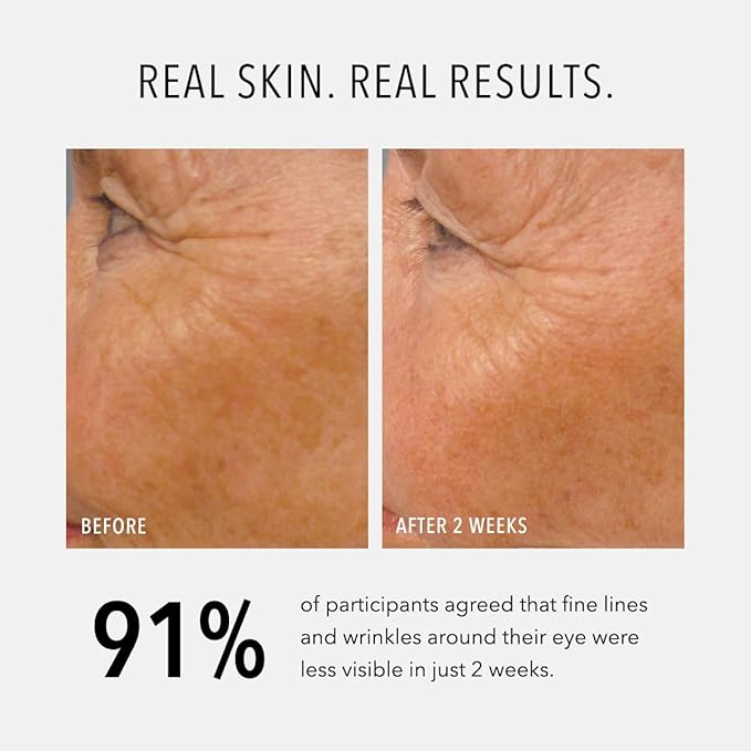 HydroPeptide LumaPro-C Face Serum, Peptide & Pigment Complexion Corrector, Nourish Skin, 1 Ounce