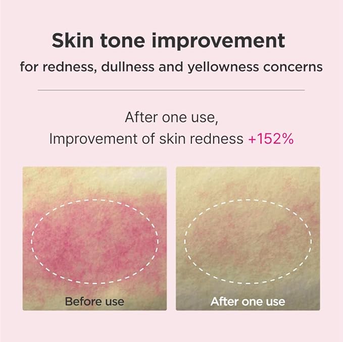 ISOI Blemish Care Up Serum Gift Set, Korean Skin Care for Hydration & Radiance – Full Size or 5-Step Travel Kit Options (5-Step Special Kit (1.77 fl.oz))