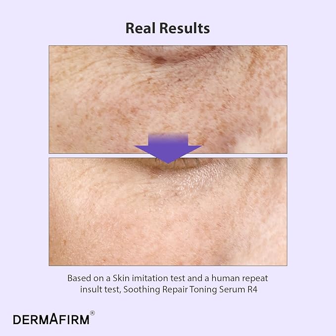 DERMAFIRM Bakuchiol Retinol Serum for Glass Skin with Niacinamide & Peptides | Daily Korean Skin Care for Sensitive Skin | Soothing Repair Toning Serum R4 for Glass Skin
