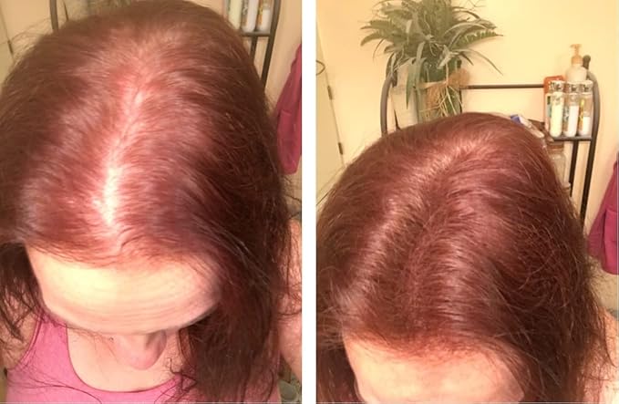 Caboki Sample Size - Get 10X Fuller Hair, Eliminate Bald Spot Instantly. All-Natural, Plant-Based Hair Fibers for Thinning Hair. Light Auburn (red/ginger hair)