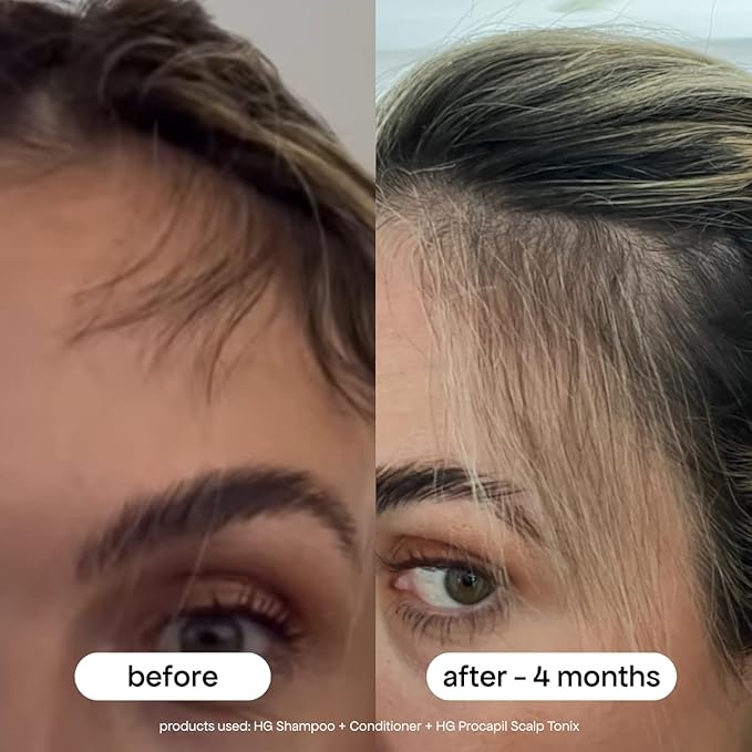 BONDIBOOST Procapil Scalp Treatment [4.23 fl oz], Daily Leave In Treatment for Thinning Hair + Anchor Hair, Scalp Serum for Thicker Hair with Procapil, Rosemary & Biotinoyl Tripeptide-1, Sulfate-Free