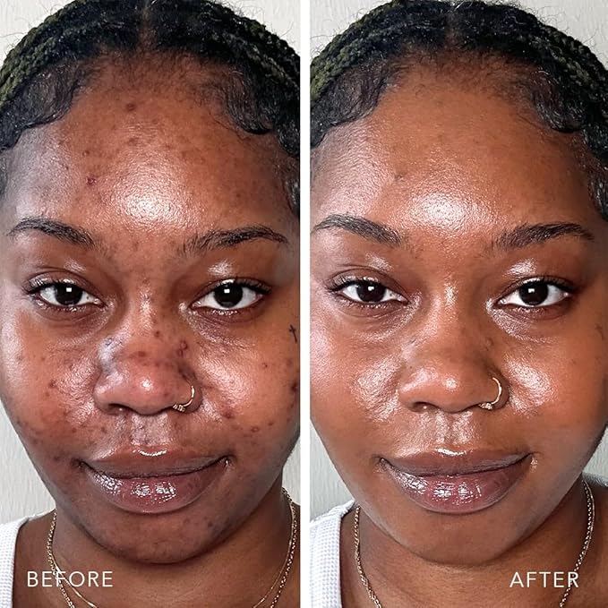 Doll 10 TCE Liquid Filter - Covers, Blurs, and Brightens (Medium)