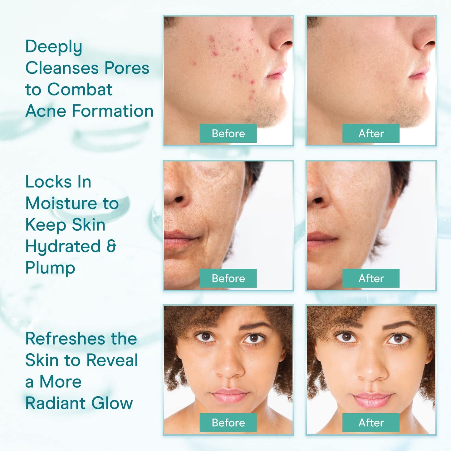 Baebody Cleansing Milk for Face - Vegan Facial Cleanser for Women and Men - Micellar Makeup Remover - Milk Cleanser Face Wash (8 fl oz)