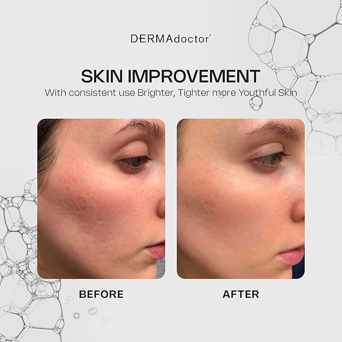 DERMAdoctor Vitamin C Face Serum 20% Vitamin C, Vitamin-E, Ferulic Acid, Ascorbic Acid Concentrated Dermatologist-Formulated Anti-Aging, Hydrating & Discoloration Correcting Serum for Face -1.0 fl oz