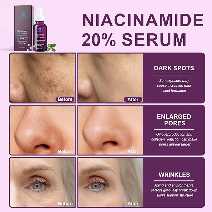 20% Niacinamide Serum for Face,Niacinamide Vitamin B3 B5 Concentrated Serum,Moisturizer,Pore Minimizer,Anti-aging Discoloration Correcting Treatment