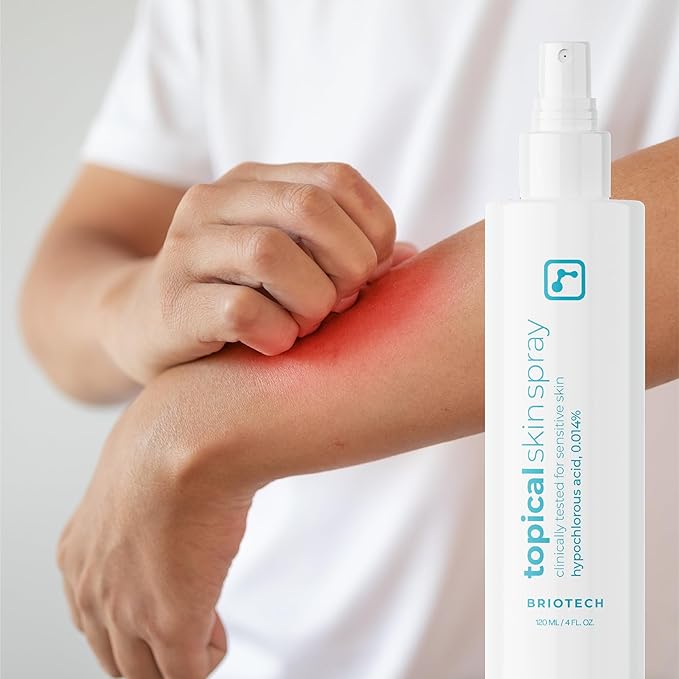 BRIOTECH Topical Skin Spray, Hypochlorous Acid Spray for Sensitive Skin, HOCl Facial Mist, Full Body Support Against Irritation, Calm Redness, Soothe Foot & Scalp, 2 oz Travel Size
