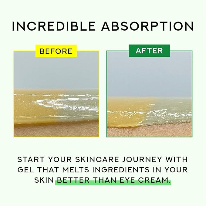 Gentle Relief Under Eye Patches | Calming Eye Treatment Gel Masks With 3-Cica Complex & Panthenol | Under Eye Masks For Dark Circles and Puffiness, Under Eye Bags, Wrinkle Care, Men and Women