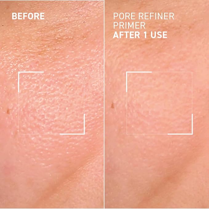 Dr. Brandt Pores No More, Pore Refiner Primer - Instantly Minimizes the Appearance of Pores, Absorbs Oil & Mattifies Shine - 1.0 fl oz