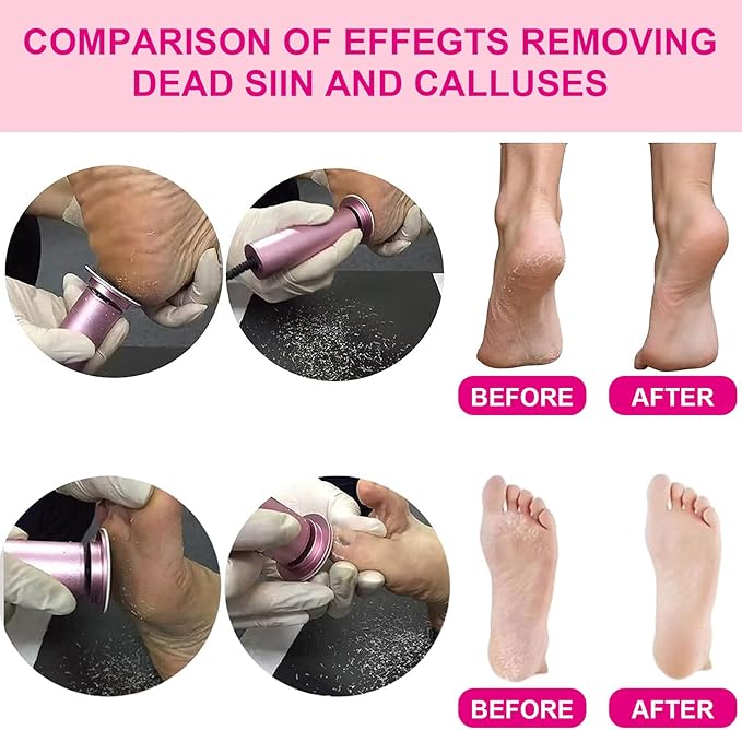 Electric Foot Callus Remover, Adjustable Foot Speed, Professional Foot Repair Tool, Equipped with 60 Pieces of Sandpaper, Suitable for Men and Women with Dead Skin calluses, Dry and Cracked, Pink