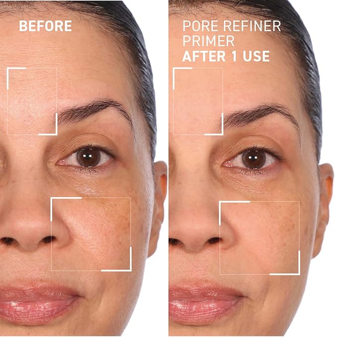 Dr. Brandt Pores No More, Pore Refiner Primer - Instantly Minimizes the Appearance of Pores, Absorbs Oil & Mattifies Shine - 1.0 fl oz