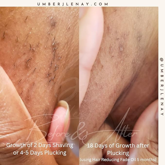 Hair Reducing Fade Oil – Regular Strength (Not sensitive skin), Minimizes Hair Growth for Face & Body – For Women & Men – 15ml Serum