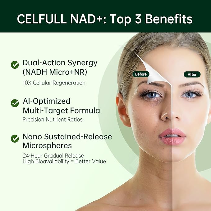 CELFULL NAD Supplement for Women with NADH,Resveratrol,Nicotinamide Riboside,Quercetin-NAD+ Boosting for Anti Aging Cellular Energy &Stamina-30000mg/Bottle