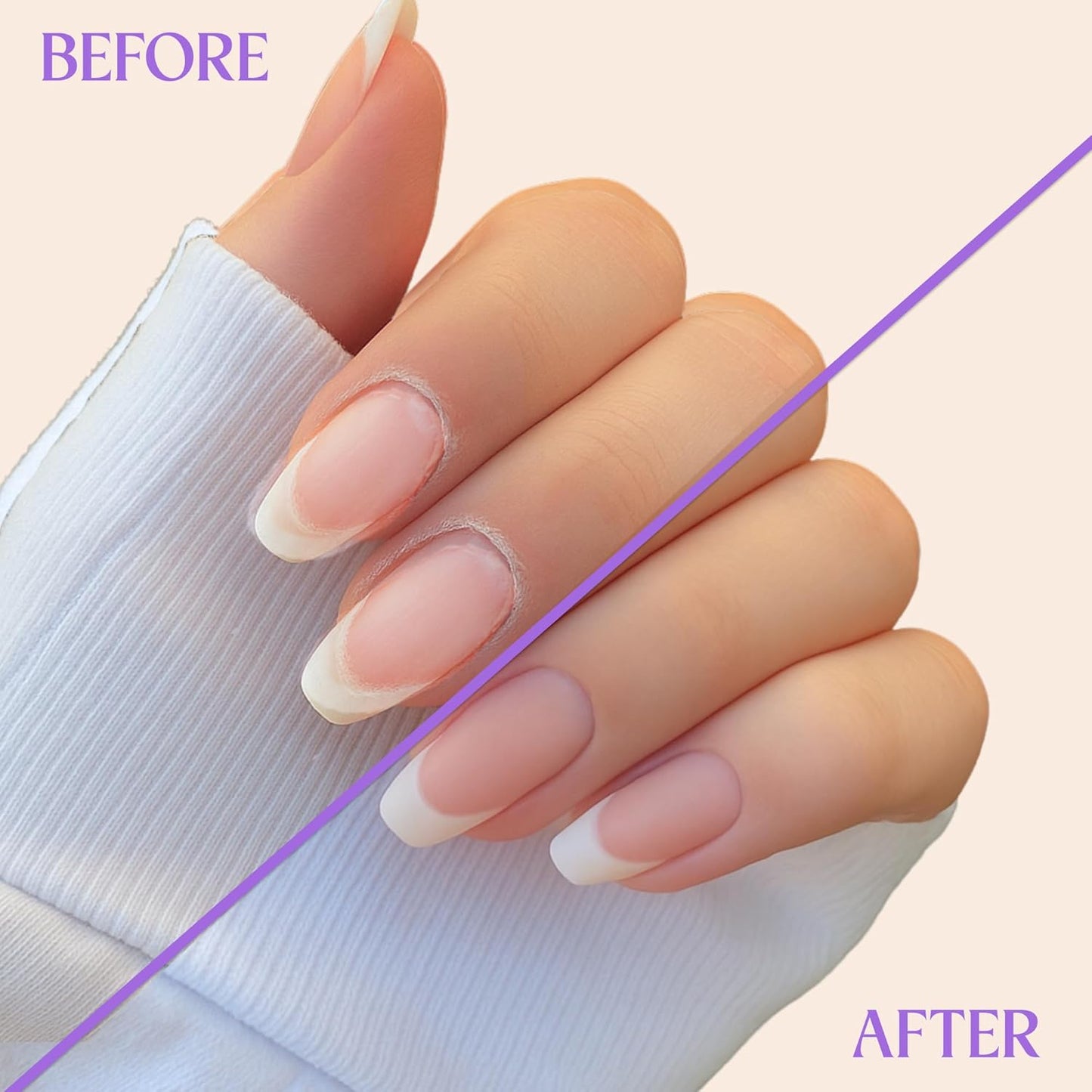 C CARE Levender and Chamomile Roll-On Cuticle Oil | Natural Revitalizing Hydrating Nail Oil | Repaires Cuticles Overnight | For Damaged Skin And Thin Nails | Paraben Cruelty Free Formula | 10ml