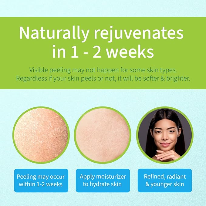 Ebanel Chemical Peel for Face, AHA BHA Exfoliator, Glycolic Acid Peel, Salicylic & Lactic Acid Face Peeling Gel, Infused with Green Tea & Chamomile for Acne Scars, Dark Spots, Wrinkles, Fine Lines