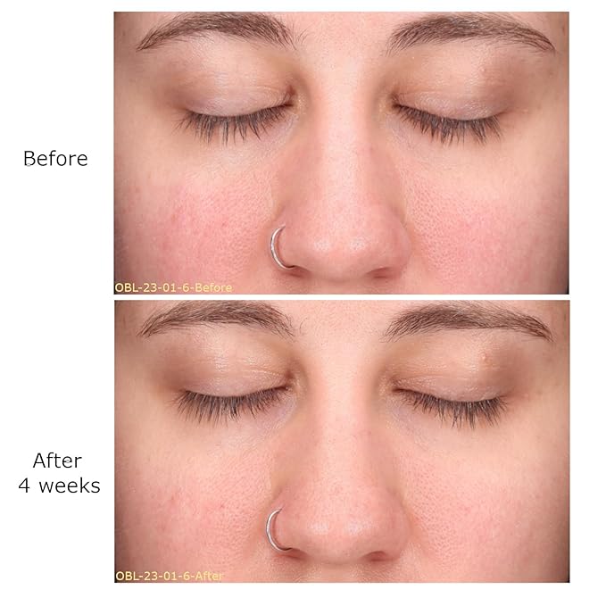 Decongest & Clarify System Collection, Activator with Clarity Facial & Azelaic Acid Concentrate, Skin Revitalizers, Care Routine, Suitable for Oily Skin, Gift Bundle / Starter Kit