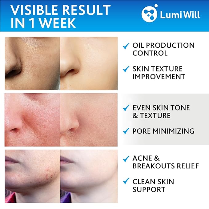 Glycolic Acid Pads - Exfoliating Pads with Glycolic Acid, Vitamins B5, C, E & Menthol - Peel Pads for Acne - Anti-Aging Glycolic Acid Resurfacing Pads for Fine Lines and Wrinkles - 50 Pads