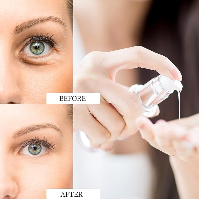 Eye Cream for Dark Circles and Puffiness - Rapid Reduction Under Eye Care Collagen Treatment Serum 1.7 oz