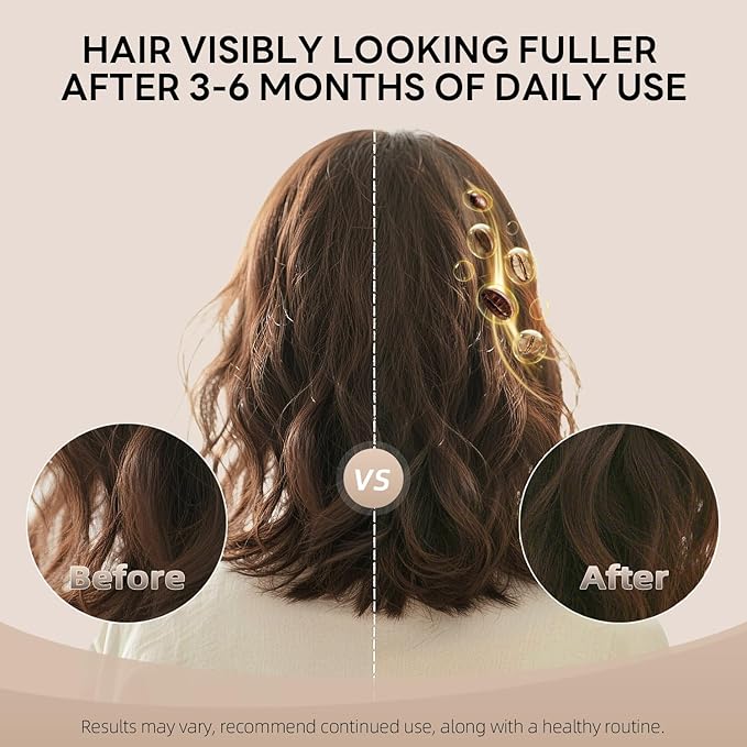 ALFHEIM Coffee+ Thickening Leave-In Conditioner | Biotin & Caffeine for Hair Growth & Strength | Lightweight, Nourishing & Volumizing Spray | Sulfate-Free, Paraben-Free | 5.4 oz