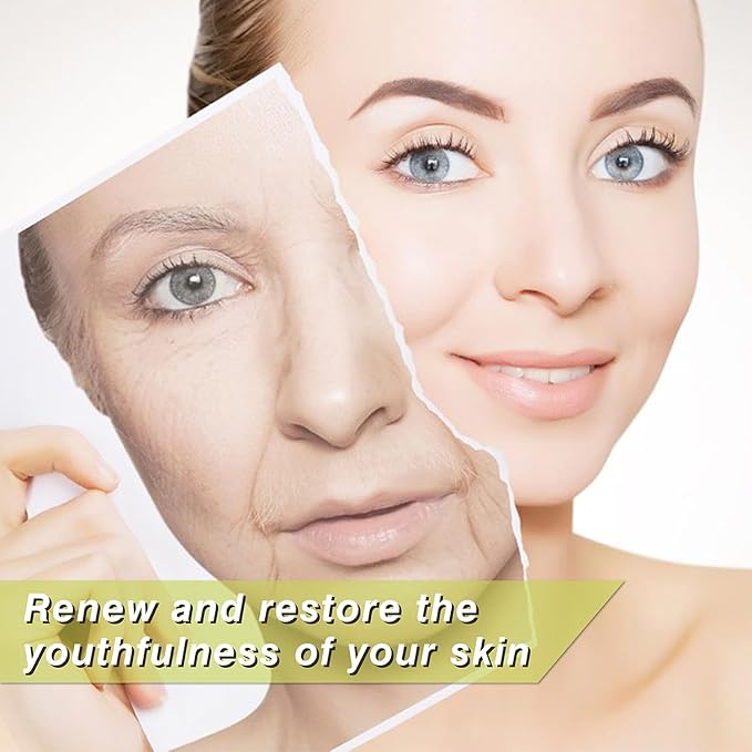 elves Pdo Threads for Eyes Lift Mono Type 30g38mm Pdo Lifting Thread for Fox Eye 40pcs Pdo Threads for Face Lift with Blunt Tips Smooting Eye Wrinkles Improves Skin's Firmness and Elasticity