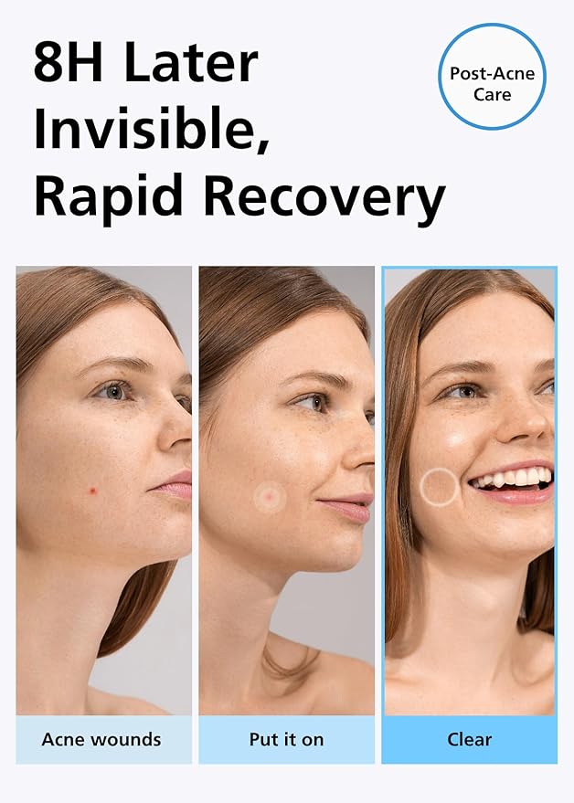 EasyDerm Beauty Patch(84 Counts) - 100% Hydrocolloid Pimple Patch for Zit Spot Care, K-beauty, Daewoong Pharmaceutical, Korean Acne Patches