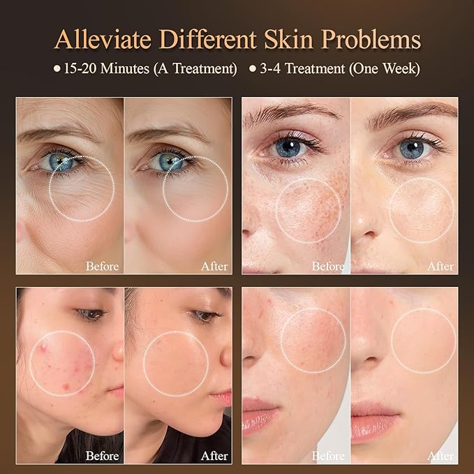 7 Colors Led Light Therapy Facial Mask, Face Light Therapy Mask for Face, Reduce Wrinkles Smooth Skin, Infrared Light Skin Rejuvenation(White)