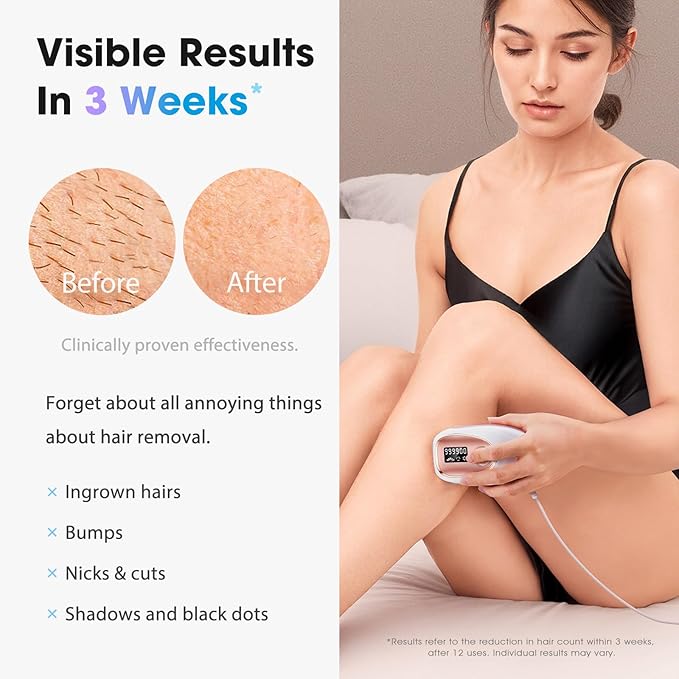 IPL Laser Hair Removal Device for Women & Men - Home 45°F Ice-Cooling Contact for Painless & Long-Lasting Results, 86% Hair Reduction in 3 Weeks for Full Body & Bikini Line, Rose Gold