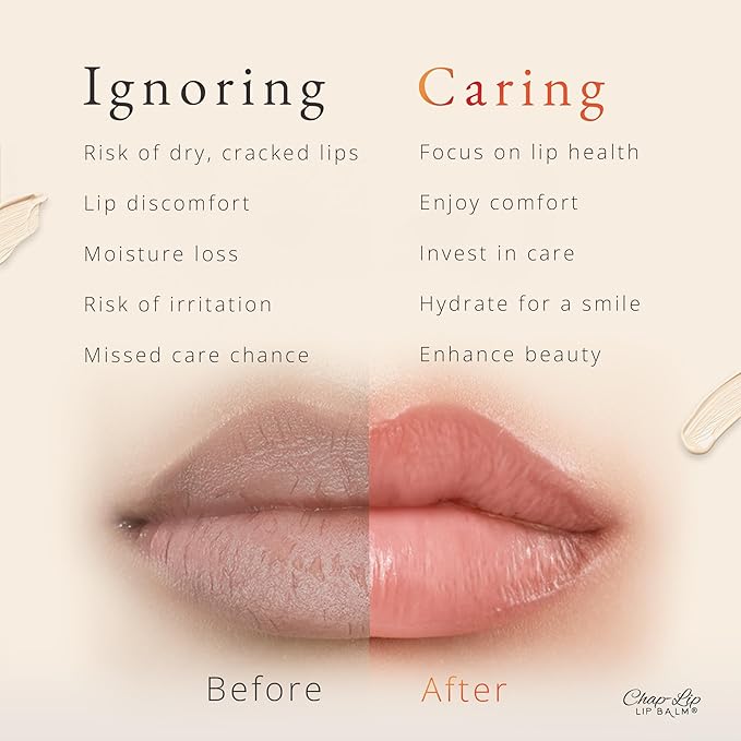 CHAP-LIP Original Lip Balm Hydrating Bulk Chap Stick with Fruit Flavors, Coconut Oil, and Cocoa Butter - Lip Therapy Pack for Men and Women - Gift Set Made in the USA, 48 Pack