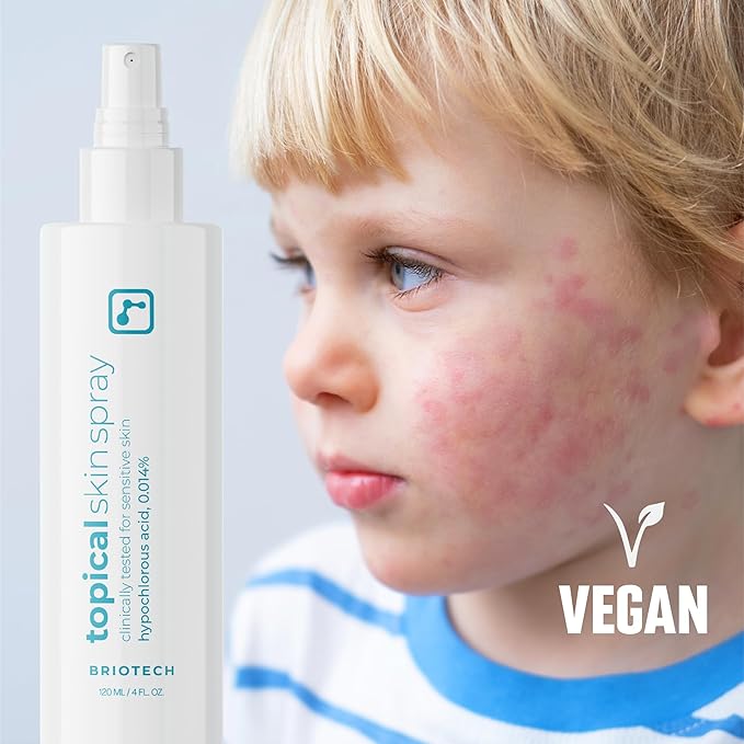 BRIOTECH Topical Skin Spray, Hypochlorous Acid for Sensitive Skin, HOCl Facial Mist, Full Body Support Against Irritation, Calm Redness, Soothe Foot & Scalp, 32 oz Refill (1 Pack)