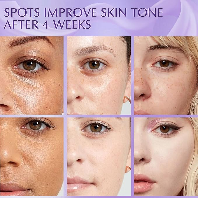 Dark Spot Remover for Face Cream, Dark Spot Corrector, Rapid Tone Repair Retinol Serum for Sun Spots, Age Spots, Skin Brown, Melasma Skin Care with Upgraded Formula Vitamin C for Women 1.7 Fl OZ