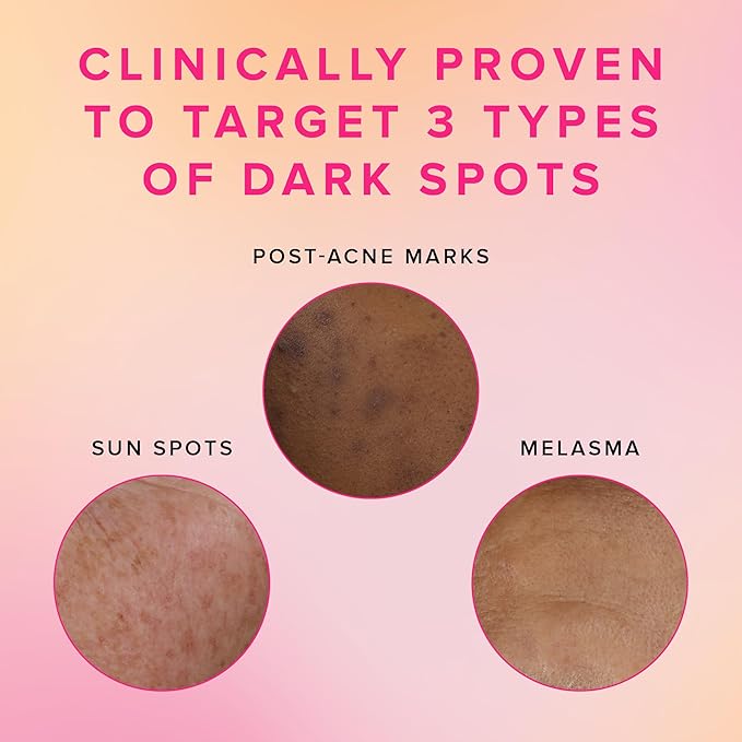 Farmacy 3% TXA Toner for Face - Brightening Face Toner for Oily Skin - Liquid Exfoliant with Azelaic Acid + 5% PHA to Target Visible Dullness + Help Reduce Uneven Skin Tone (50ml)