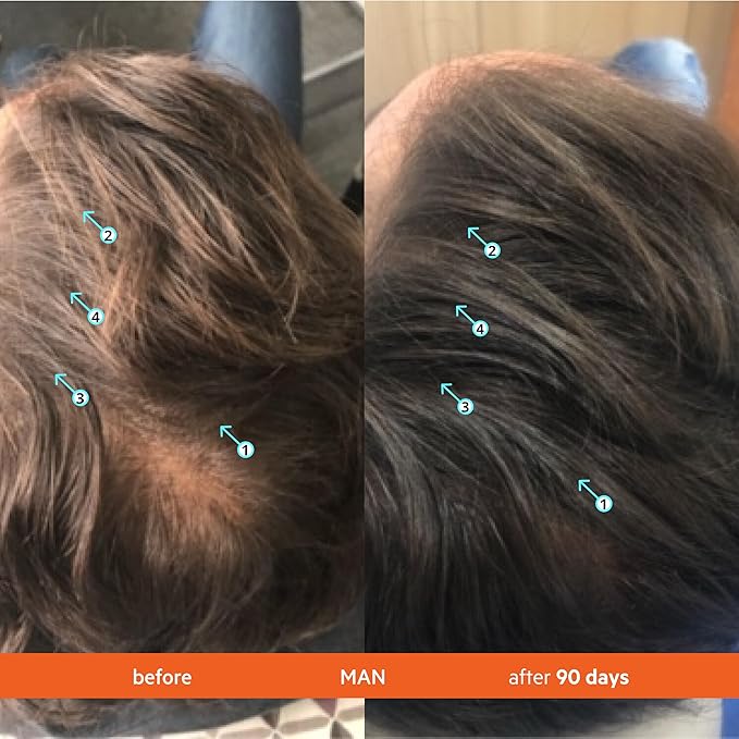 DS Labs Revita Shampoo – High-Performance Hair Density Shampoo, Volumizing & Thickening, Fuller, Healthier-Looking Hair, Sulfate & Silicone Free, For Men & Women, 500mL, Packaging May Vary