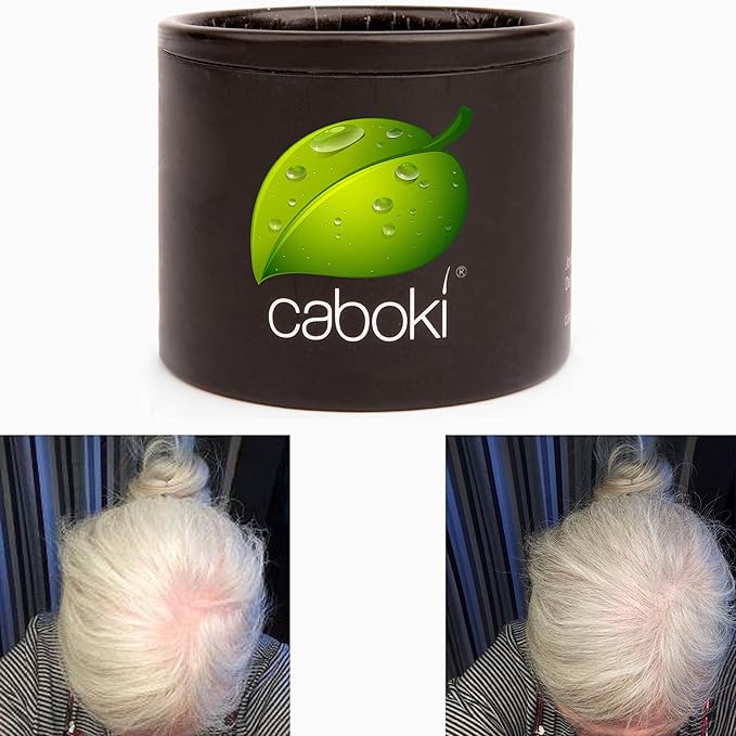 Hair Thickening Fibers. Cover Bald Spot and Thinning Hair Instantly. Make Thin Hair Look 10X Fuller. All-Natural Hair Building Fiber. Trial Size (10-Day Supply). Silver/White