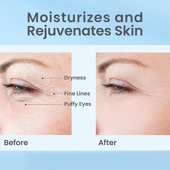 Hydrate& Replenish EYE CREAM- Gel Hydrator-Cream with Hyaluronic Acid & Marine Extracts, attracts moisture to the skin Algae And Seaweed Extracts to revitalize dull looking skin 0.5 Oz