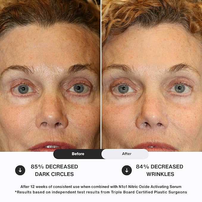 Age-Defiance Eye Cream - Day & Night Moisturizer with Nitric Oxide, Hyaluronic Acid, Complex Peptides, Ceramides - Hydrating Eye Cream for Dark Circles, Wrinkles, Fine Lines, Puffiness - 0.5 oz.