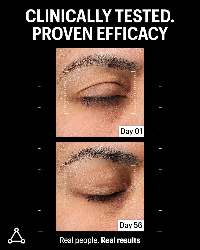 Allies of Skin Multi Peptides & Growth Factor Collagen Boosting Face Serum | Skin Tightening Anti-Aging Complex with 9% Peptides| Firms Sagging Skin & Visibly Reduces Wrinkles (1 oz)