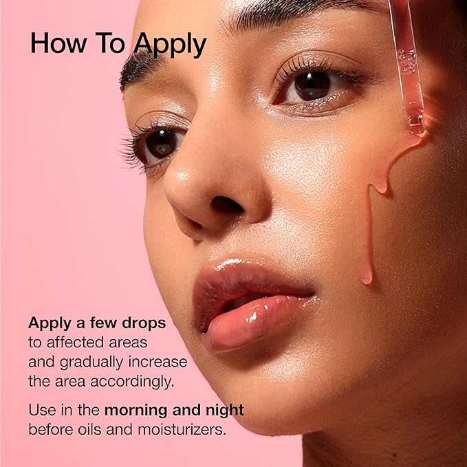 ANUA Niacinamide 10 + TXA 4 Serum, Hyaluronic Acid, Tranexamic acid, Facial Serum for Glass Skin, Clarifying, Radiant Complexion with Natural Color, Korean Skin Care (30ml /1.01 fl.oz)