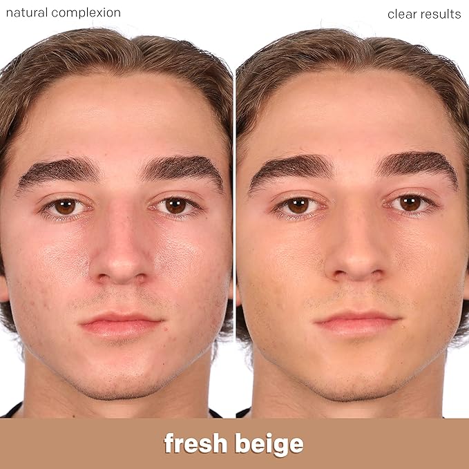 Almay Clear Complexion Acne Foundation Makeup with Salicylic Acid - Lightweight, Medium Coverage, Hypoallergenic, -Fragrance Free, for Sensitive Skin , 700 True Beige, 1 fl oz.