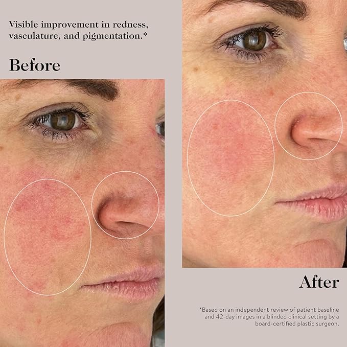 goop Beauty Peptide Serum |Reduces Fine Lines, Wrinkles, & Dark Spots | Peptides, Ceramides, & Niacinamide | Anti Aging Treatment to Improve Firmness & Elasticity | 1 fl oz