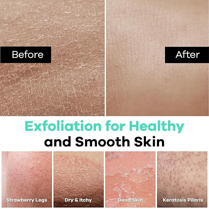 Dermasuri Deep Exfoliating Glove - Polishing Mitt Body Scrubber - Korean Skin Cleaner Exfoliator & Dead Skin Buffing Treatment - Keratosis Pilaris Scrub Remover- Shower Skincare (1 Pack)